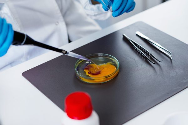 Cuándo contratar una consultoría de seguridad alimentaria